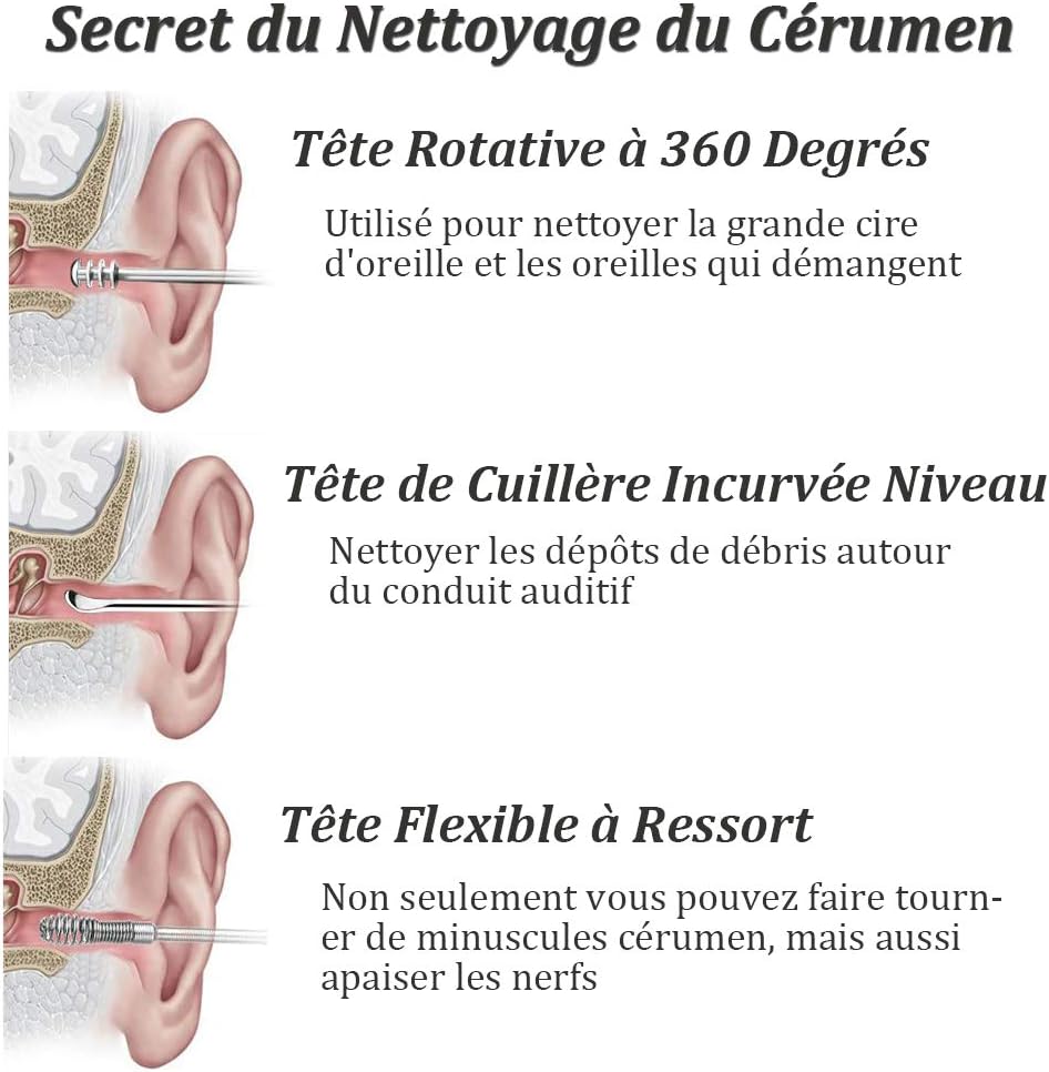 Le kit de nettoyage d'oreilles professionnel par excellence â Nettoyeur de cĂ©rumen